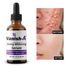  Vanish-A Strong Brightening Serum ( 1 fl oz ) - Good Brands USA